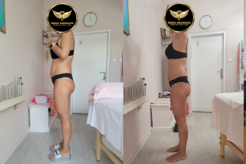 Výsledky mojej práce. Premeny pred a po.